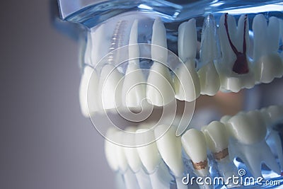 Dental teeth dentistry model Stock Photo