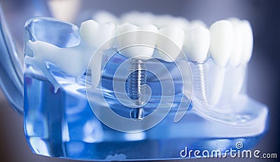 Dental teeth dentistry model Stock Photo