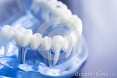 Dental teeth dentistry model Stock Photo