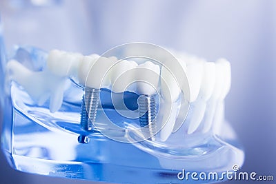 Dental teeth dentistry model Stock Photo