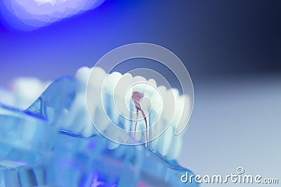 Dental teeth dental model Stock Photo