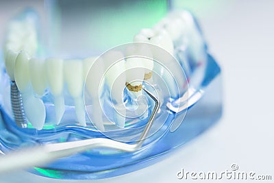 Dental teeth dentist model Stock Photo