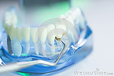 Dental teeth dentist model Stock Photo