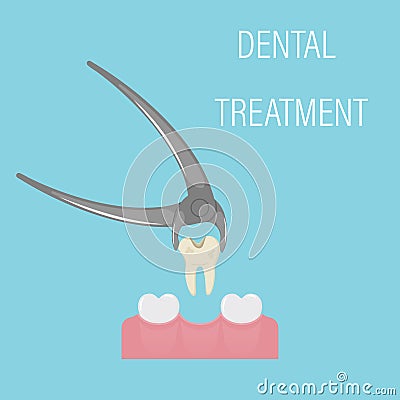 Dental tooth extraction. Exodontia. The tooth in the dental forceps. A white clean tooth is clamped between the forceps. Cartoon Illustration