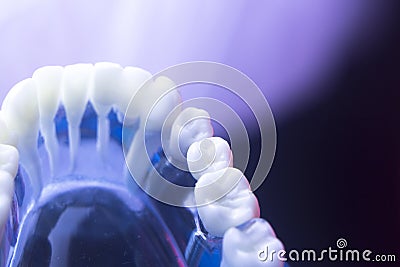 Dental tooth health decay Stock Photo