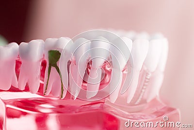 Dental tooth root model Stock Photo