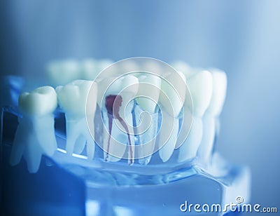 Dental tooth root model Stock Photo