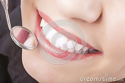 Dental Treatment with Mouth Mirror of Young Caucasian Female During Her Oral Examination Stock Photo