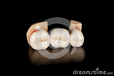 Dental veneers, ceramic and zirconium crowns of teeth close-up macro isolate on black background. Laboratory technical production Stock Photo