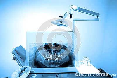 Dental X-ray Stock Photo