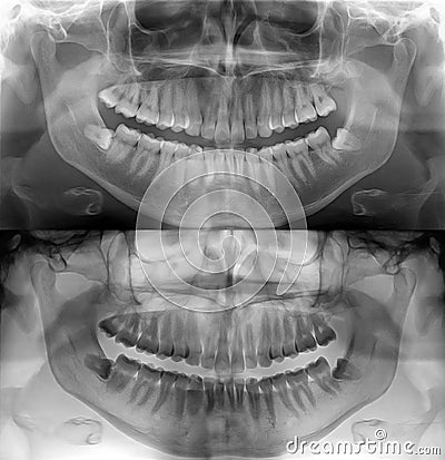 Dental x-ray Stock Photo