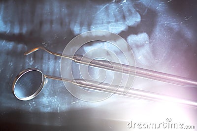 Dental x-ray and dental mirror Stock Photo