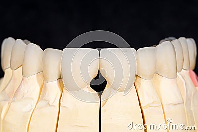 Dental zirconia bridge Stock Photo
