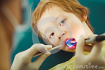 Dentist applies ultraviolet light to child`s teeth after caries removal. Stock Photo