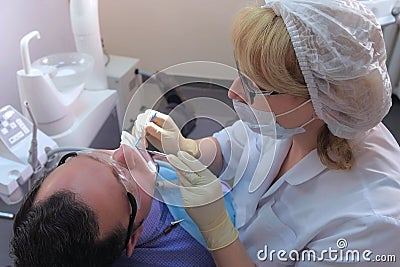 Dentist is applying blue gel on man`s teeth to find dental tartar and caries. Stock Photo