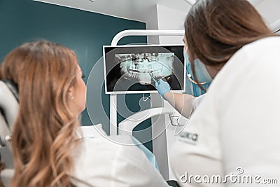 The dentist carefully analyzes the MRI image of the oral cavity in order to plan treatment. The patient receives an Stock Photo
