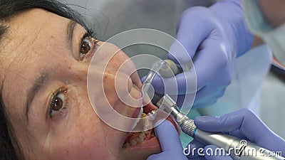 Dentist changes the brush of prophy cup Stock Photo