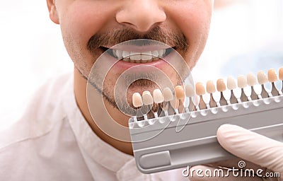 Dentist checking young man`s teeth color Stock Photo