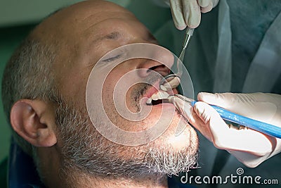 Dentist checks a man's teeth for general oral hygene Stock Photo