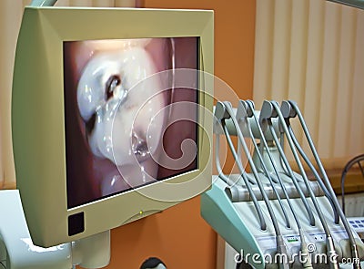 At the dentist - close up Stock Photo