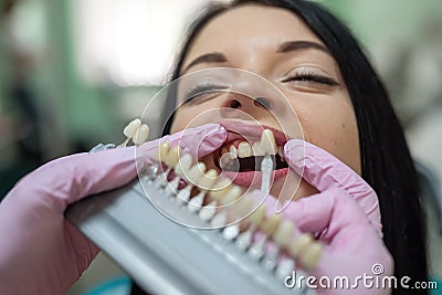 Dentist comparing patient& x27;s tooth with color sampler Stock Photo