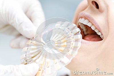 Dentist comparing teeth of patient with samples Stock Photo