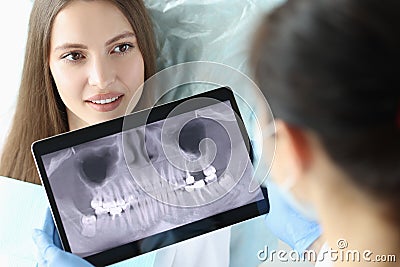 Dentist doctor holding digital tablet with teeth xray in front of patient Stock Photo