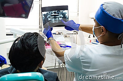 Dentist Doctor keeps in the hands of X-ray picture of the human jaw Stock Photo