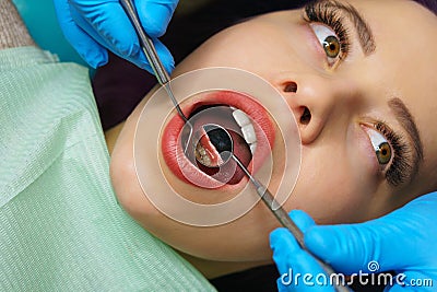 Dentist examines teeth of girl Stock Photo