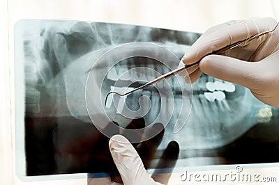 Dentist examining panoramic dental x-ray Stock Photo