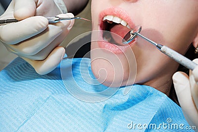 A dentist examining a patientâ€™s teeth in the dentistry. A close-up of a patientâ€™s teeth and mouth Stock Photo