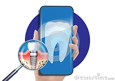Dentist examining teeth on smartphone Vector Illustration