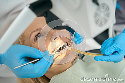Dentist filling teeth with the special equipments Stock Photo
