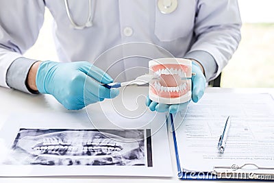 Dentist hand holding of jaw model of teeth and cleaning dental with toothbrush Stock Photo