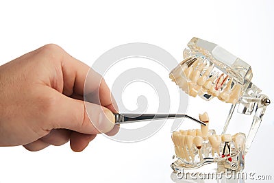 Dentist hands pulls out a tooth with dental forceps Stock Photo