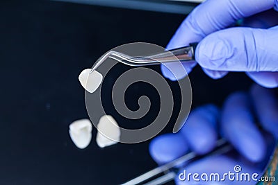 A dentist is holding tweezers for dental ceramic veneers and crowns. Stock Photo