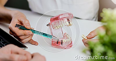dentist implantologist showing dental implant technology on tooth jaw model to patient Stock Photo