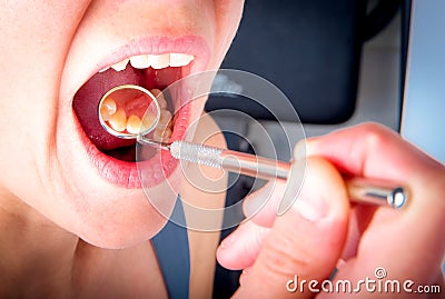 Dentist mirror reflects backend of front teeth Stock Photo