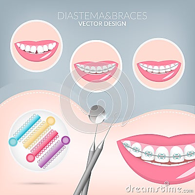 Dentist, orthodontist. Teeth healthy and dental braces Cartoon Illustration