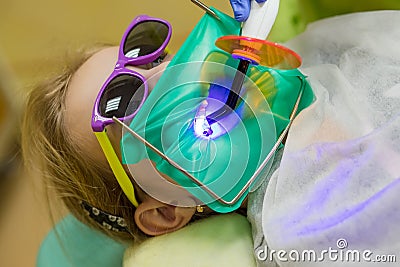 Dentist performing dental filling procedure to preteen girl in pediatric dental clinic. Doctor removing caries using Stock Photo