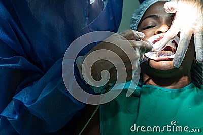 Dentist performing dental treatment procedure at the dental clinic Stock Photo