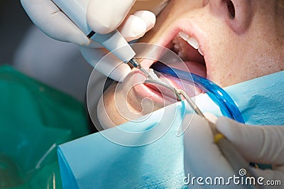 Dentist performing a scan on his patient Stock Photo