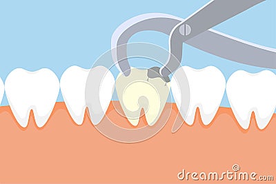 Dentist pulling out a dead tooth with equipment. Dental care activities with a dentist nipper and a dead tooth vector. Dead tooth Vector Illustration