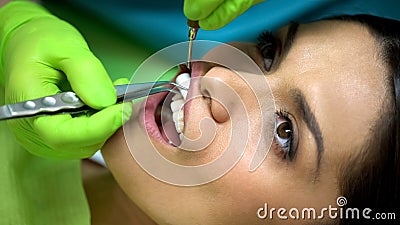 Dentist putting cotton ball in female patient mouth, isolation from saliva Stock Photo