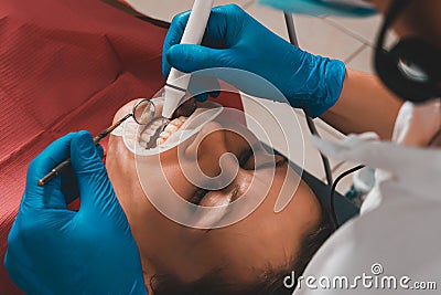 At the dentist`s appointment, tartar removal, use of ultrasound, patient and dentist. Retractor for isolation of lips and gums Stock Photo