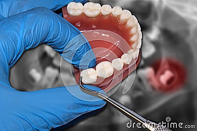 Dentist show molar over dental teeth model mold Stock Photo