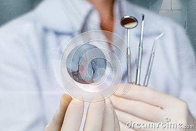 A dentist stomatologist shows a snapshot of a diseased tooth Stock Photo