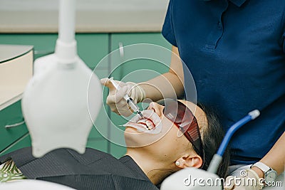 Dentist stomatologist whitening teeth for patient. Application of protective whitening gel to the teeth. Woman with an Stock Photo