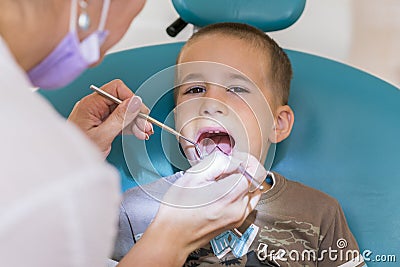 Dentist is treating a boy`s teeth. Children`s dentistry, Pediatric Dentistry. A female stomatologist is treating teeth of Stock Photo