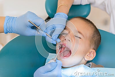 Dentist is treating a boy's teeth. Dentist examining boy's teeth in clinic. A small patient in the dental chair smiles. Dantist Stock Photo